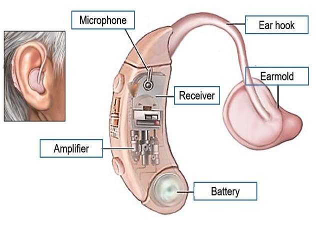 Hearing Aid HA And Its Components