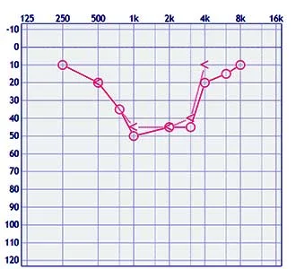 Cookie-bite-audiogram