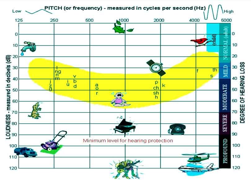 speech-banana-audiogram