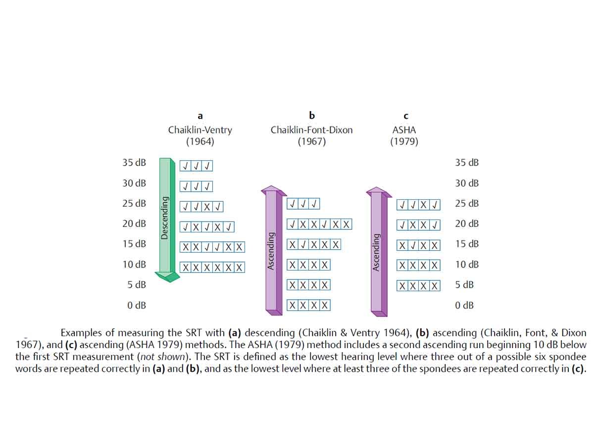 speech-reception-thresholds-procedure-and-application