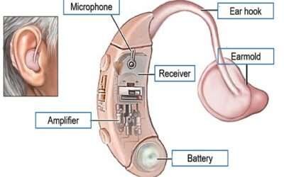 Hearing Aid (HA) and its Components
