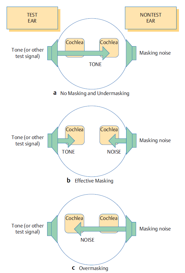 concept-of-the-plateau-method-during-undermasking-effective-masking-and-overmasking