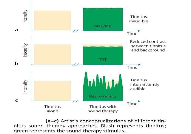 Tinnitus and Medical line of Treatment