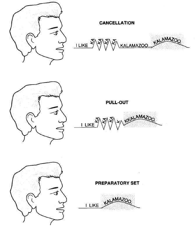 Different Techniques and Strategies used in Management of Stuttering