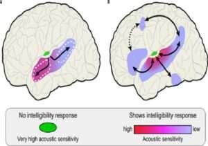 Neurolinguistic Models of Language Processing