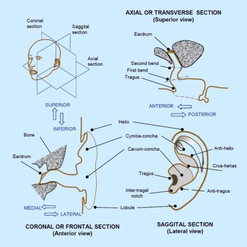 Types of Earmolds for Hearing Aid - Skeleton | Custom