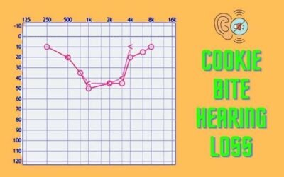 Cookie Bite Hearing Loss: Reverse | Dementia | Best Hearing Aids