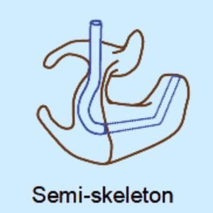 Types of Earmolds for Hearing Aid - Skeleton | Custom