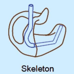 Types of Earmolds for Hearing Aid - Skeleton | Custom